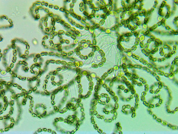  Cyanobacteria Under Microscope  Acton Wakefield 